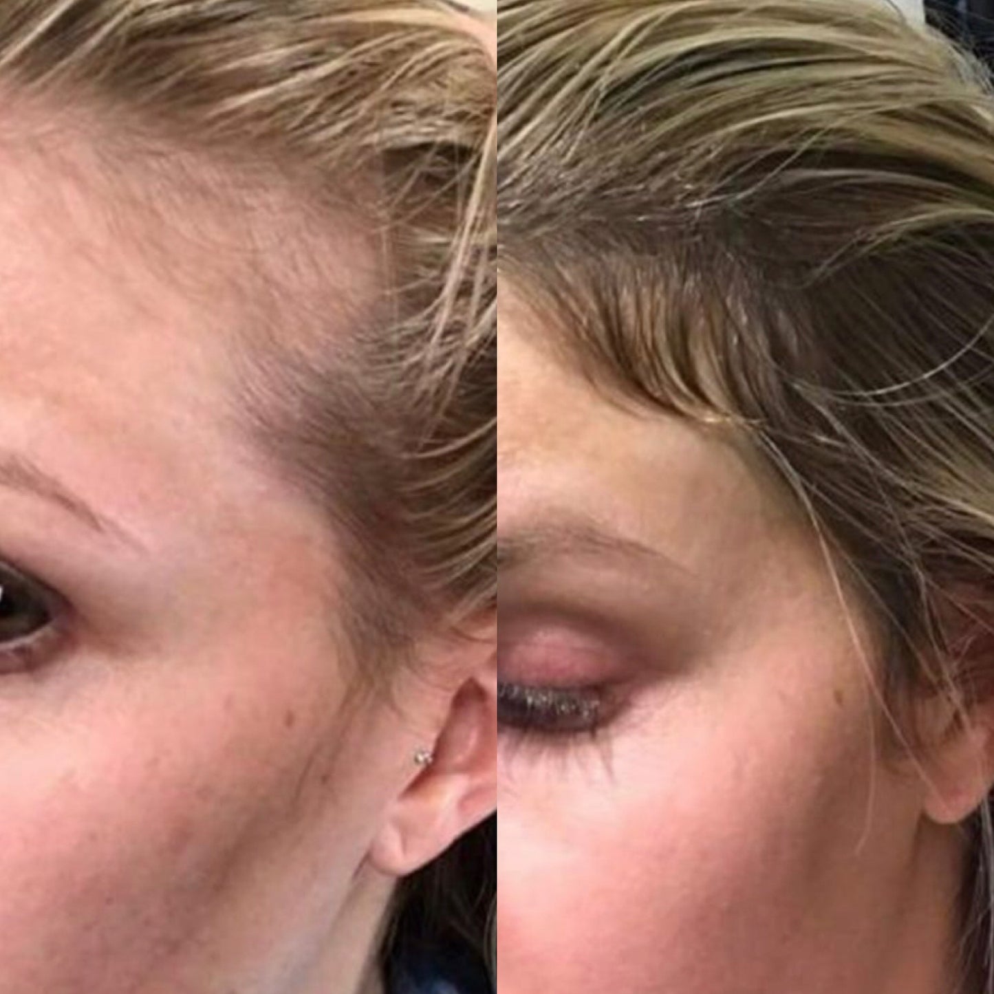 True Beauty Collagen Capsules
