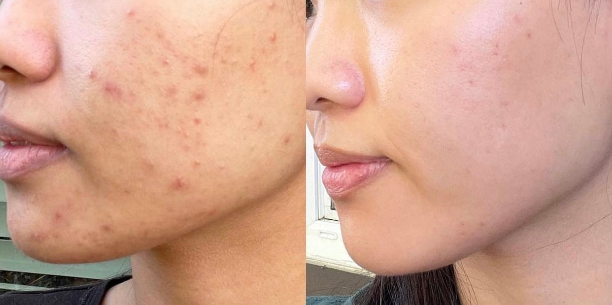 Glow Beauty Collagen Capsules