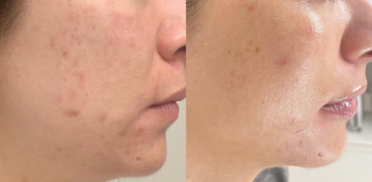 Glow Beauty Collagen Capsules