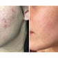 Glow Beauty Multi Mix Collagen