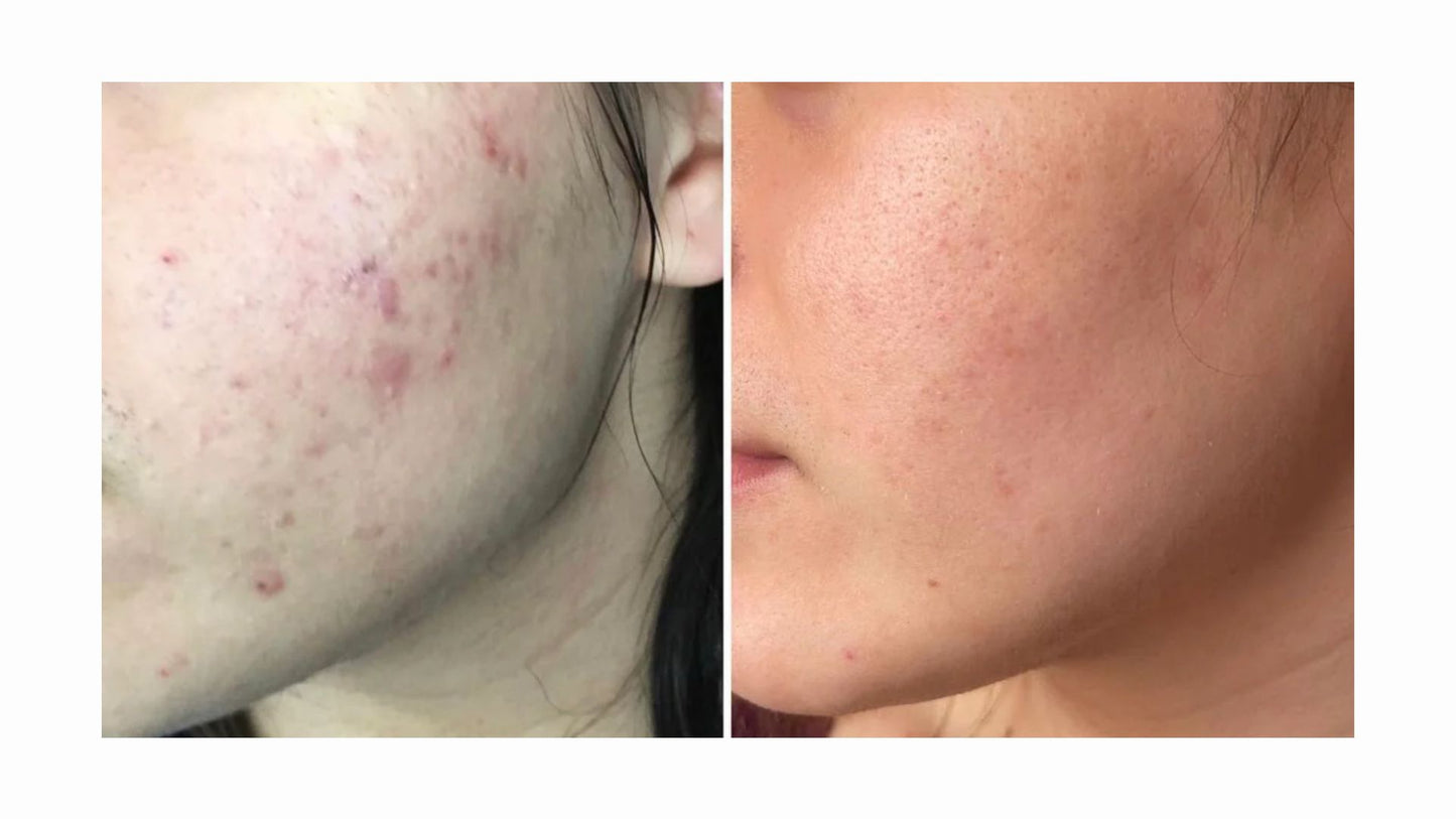 Glow Beauty Multi Mix Collagen