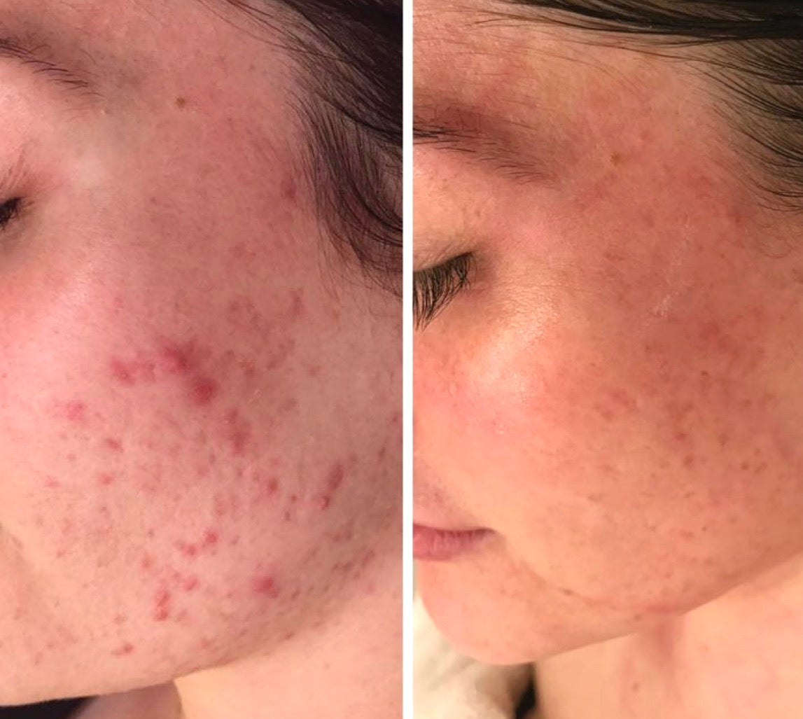 Glow Beauty Bovine Collagen
