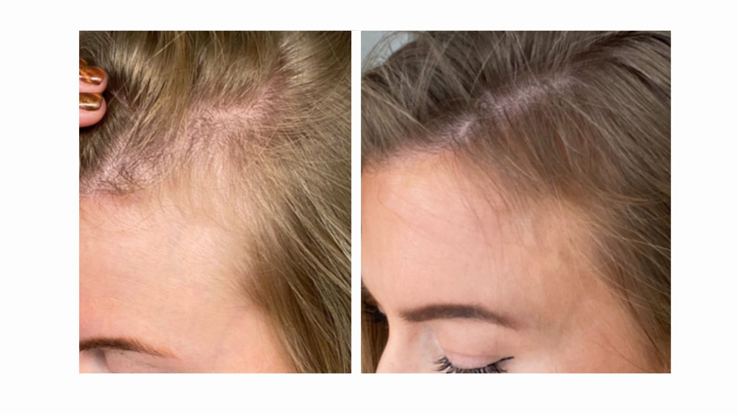 Glow Beauty Multi Mix Collagen
