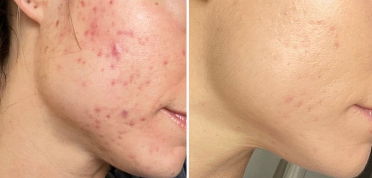 Glow Beauty Multi Mix Collagen