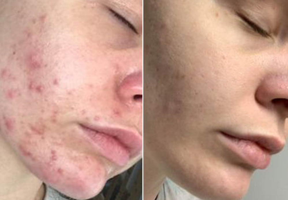 Glow Beauty Collagen Powder